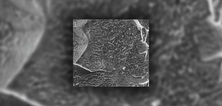 Titan Spine: New ICD-10 Code