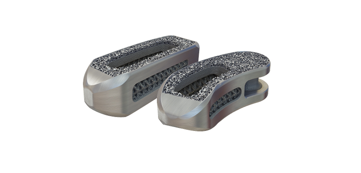 Spineart: Clearance to Market Interbody Devices