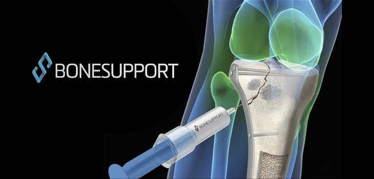 Trial to Study Ultra-High Antibiotic Bone Graft Substitute CERAMENT G