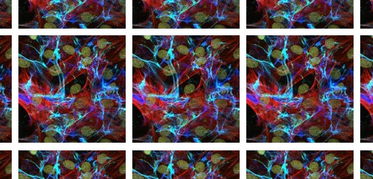 Pitt, McGowan Institute Advance Bioscaffold Knowledge