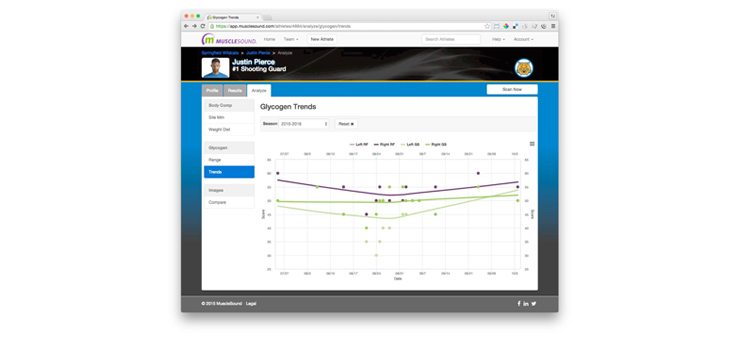 Kansas City Royals Choose MuscleSound to Track Healing Rates