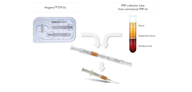 CollPlant: Positive Results for Tendinopathy Product
