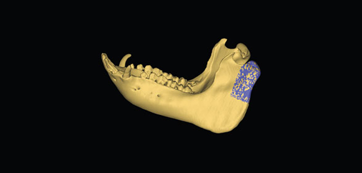 Stem Cell Laced Grafts Grow Bone in Pigs