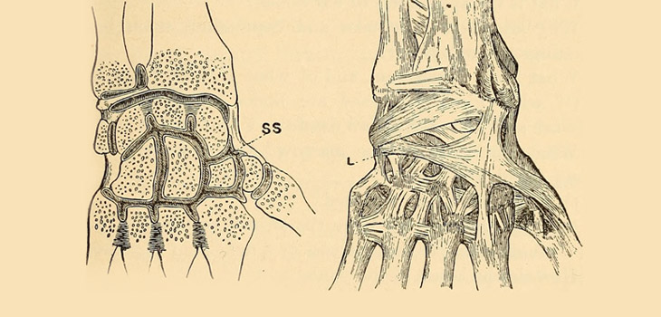 Broken Wrists Signal Elevated Hip, Spine Fracture Risk