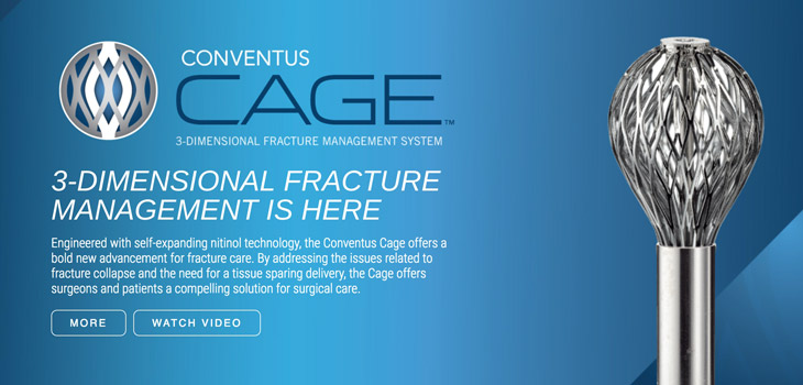 Conventus: 510(k) for Ulna Systems