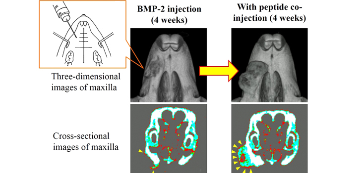 Protein/Peptide Combo and Gel Promote Bone Formation