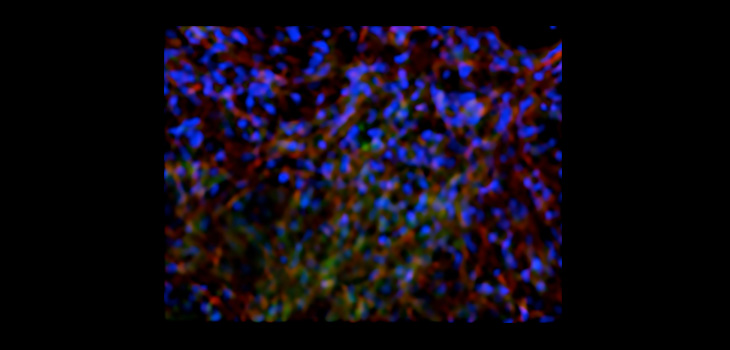 Feed Molecule to Stem Cells, Get Bone Regeneration