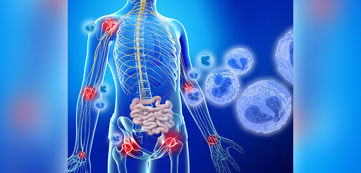 Lethal Inflammatory Disease: Otulipenia