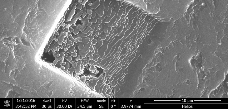 Graphene Flakes=Bone Implants?