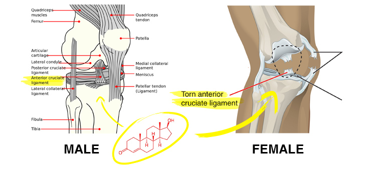 Male Testosterone Responsible for Sex Differences in ACL Injuries?