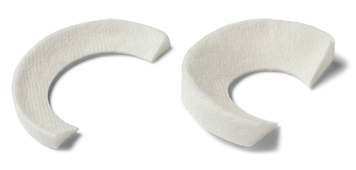 Stryker Acquires ReGen Biologics’ Meniscus Implant