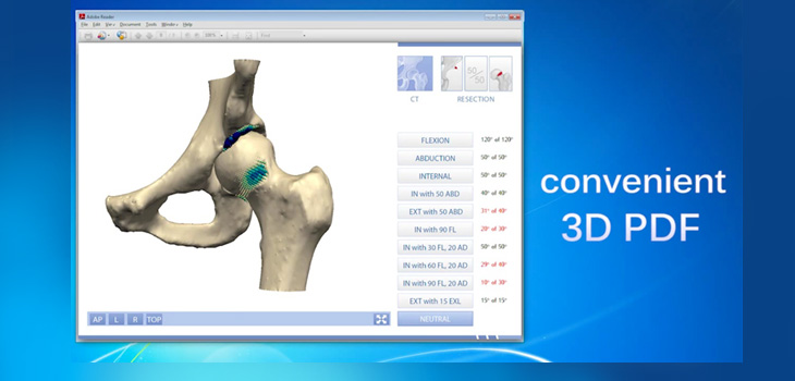 Zimmer Biomet Acquires 3D Simulation App