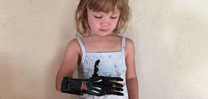 3D Printing Creates Low-Cost Prosthetic Hands for Children