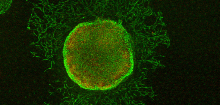 Human Extracellular Matrix Works in Cartilage Formation
