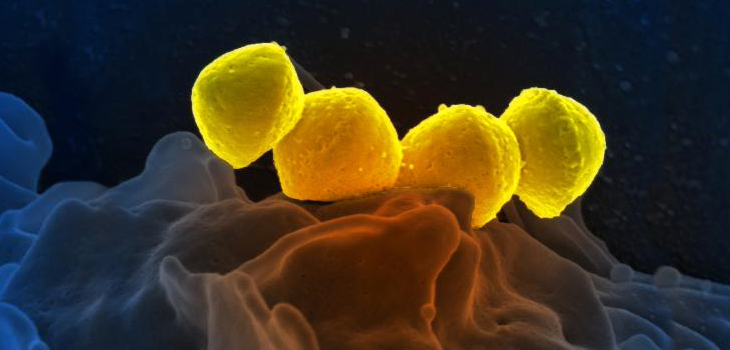 RA Drugs Increase Flesh-Eating Strep Risk!?;Back to Running After Femoral Neck Stress Fractures; Women STILL Vastly Underrepresented in Orthopedics