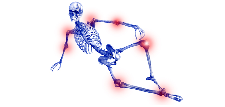 Found: New Info on Knee Pain Distribution