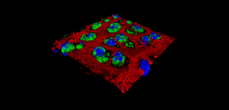 Post-Injury Nanoparticles Suppress Inflammation!