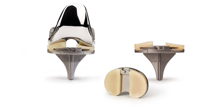 Zimmer Biomet’s New Vanguard Knee Will “Revolutionize” TKA