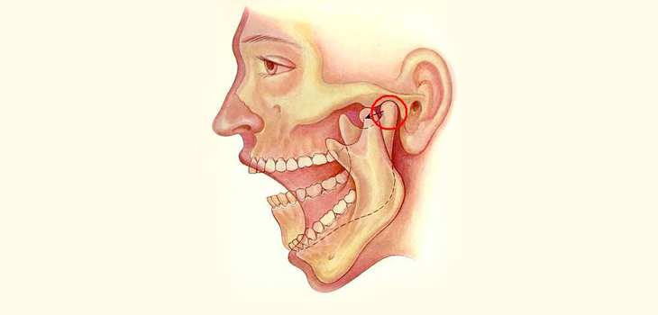 Mice Stem Cells Suggest TMJ Treatment