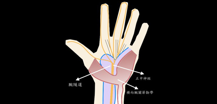 Chinese Research Favors Double Incision Carpal Tunnel Surgery