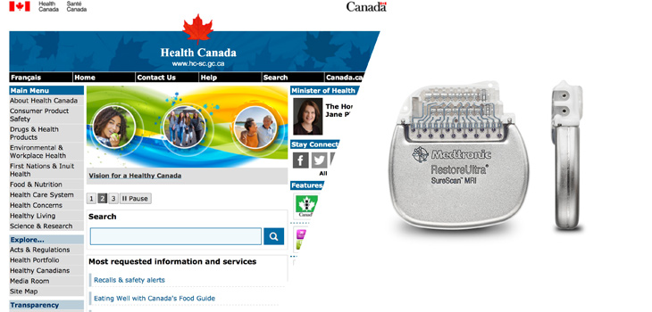 Health Canada Licenses Medtronic MRI Conditioning Spinal Cord Stimulator