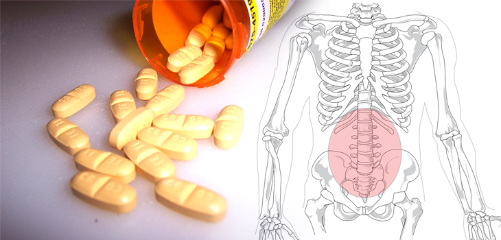 Opioids for Back Pain: Limited Relief, Concern About Stigma