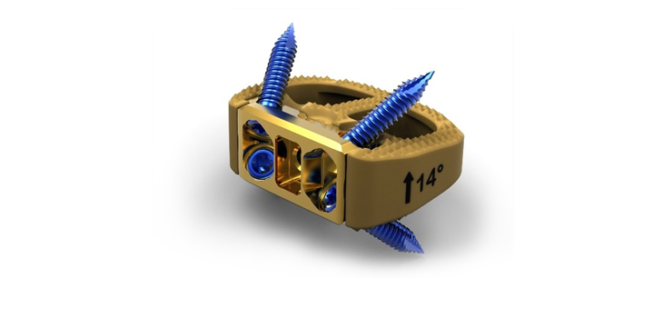 Surgical Efficiency Highlights DePuy Synthes New ALIF Implant System