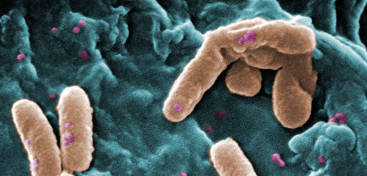 New Coating Defeats Implant Infections