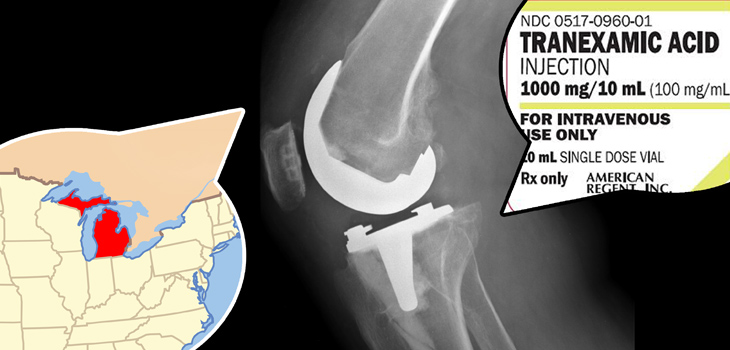 Tranexamic Acid in Joint Arthroplasty; Novel Osteoporosis Therapy; Price Shopping Patients