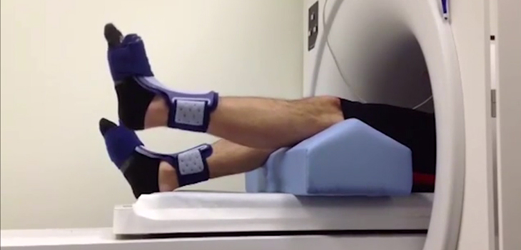 Brain Needs Retraining After ACL Injury