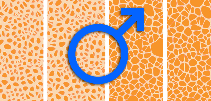 Romosozumab Increases BMD In Men With Osteoporosis