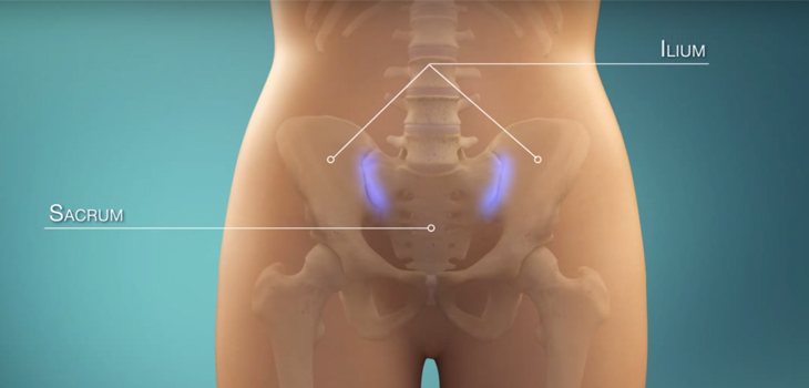 Zyga Technology: Positive Results for SImmetry