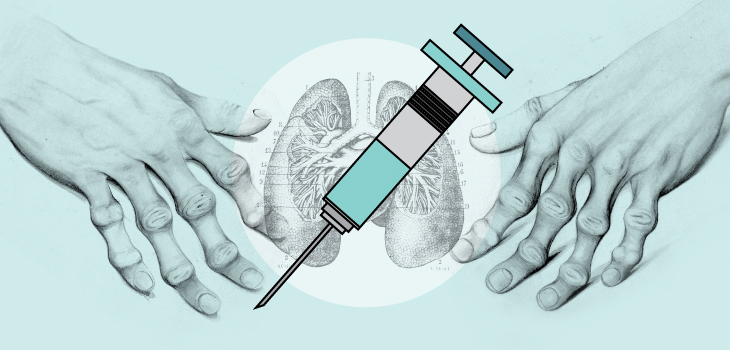 Rituximab Lowers Death Risk in RA Patients With Lung Conditions?