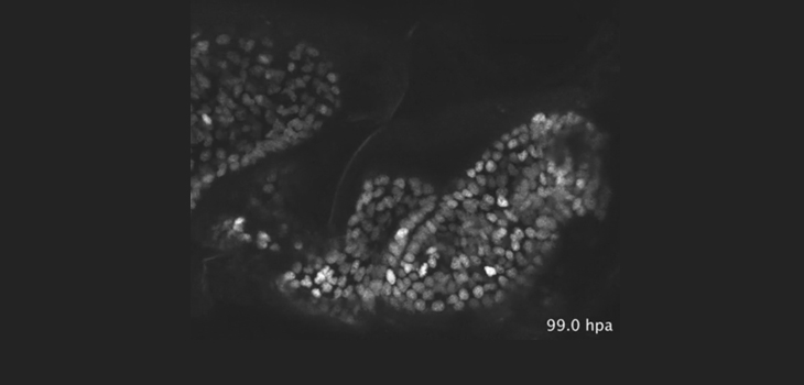 World’s First! Time-Lapse Footage of Limb Regeneration