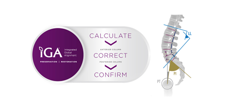 NuVasive: New Spine Technology Introductions