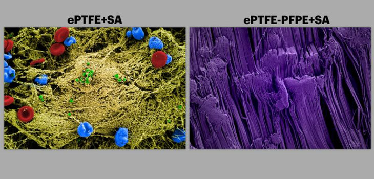 Carnivorous Plant Inspires Progress on Implant Coatings