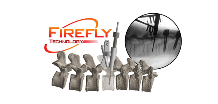 Mighty Oak Medical: Second FDA Clearance for FIREFLY