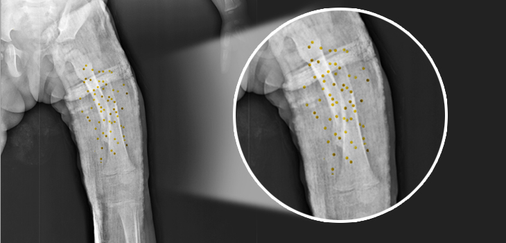 Gold Nanoagents in X-Rays Reveal Microcracks in Bones