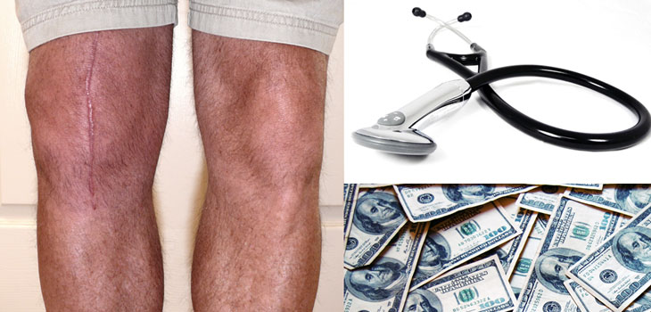 Patient Perceptions of Surgeon Reimbursement