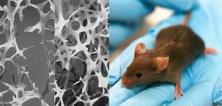 New Growth Factor Reverses Osteoporosis in Mice