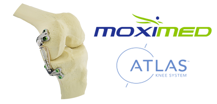 Moximed: First Patient for IDE on Atlas System