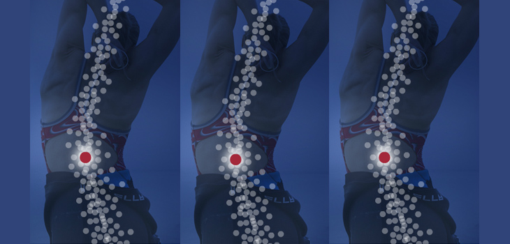 Radio Frequency Energy Kills Low Back Pain