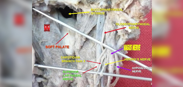 The Vagus Nerve, Inflammation, and Pain