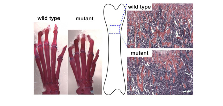 Skeletal Defects Caused by Protein Loss