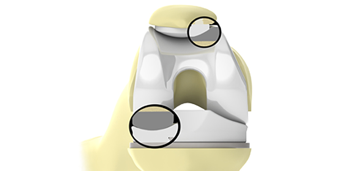 OMNIBotics: 10th Anniversary of Apex Knee