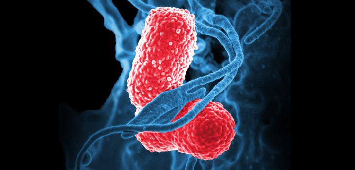 ACS, SIS: New Guidelines for Surgical Site Infections