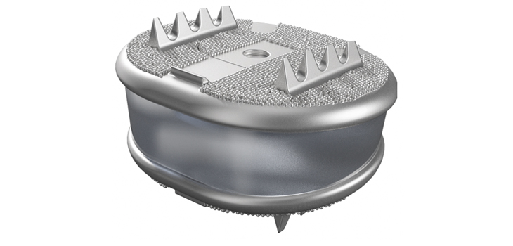 First AxioMed Viscoelastic Disc Inserted in Australian Patient