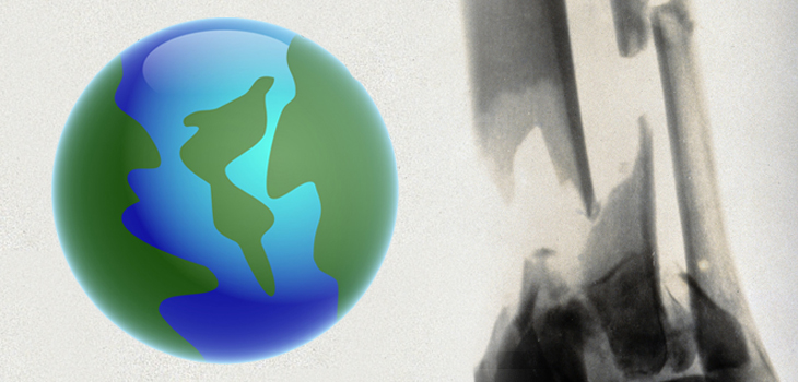 Global Orthopaedic Trauma Care: Where We Stand
