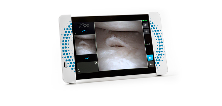 In-Office $450 MRI Alternative; “First-in-the-NFL” Ankle Study; No “July Effect” for Orthopedic Training?