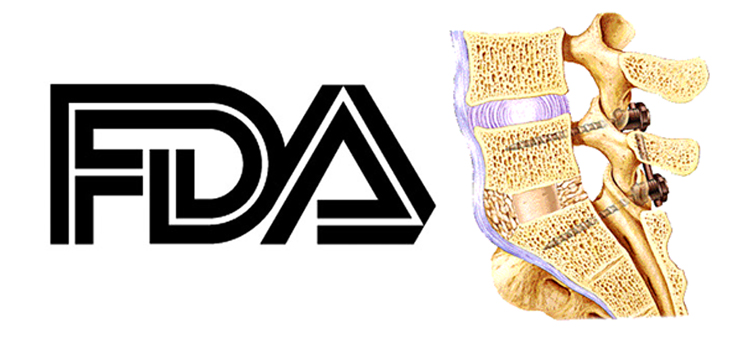 FDA Reclassifies Pedicle Screws